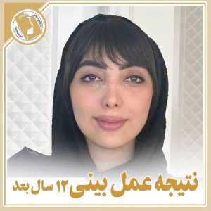 Of nose surgery | Rhinoplasty Isfahan | One year after rhinoplasty