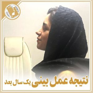 جراح بینی اصفهان | جراحی زیبایی بینی اصفهان | گذشت یک سال و نتیجه جراحی بینی دکتر مجید راستی