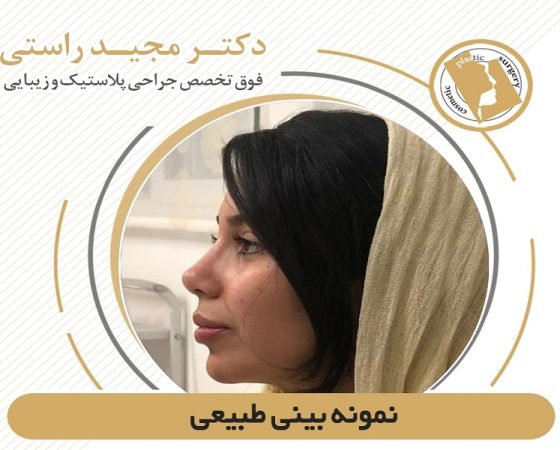 Échantillon de rhinoplastie naturelle par le Dr Majid Rasti, nos documents lisibles et suggérés pour vous
