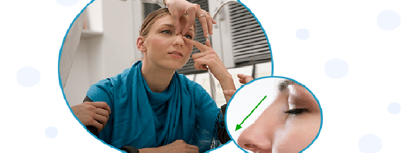 Everything you need to know about reconstructive rhinoplasty . . .