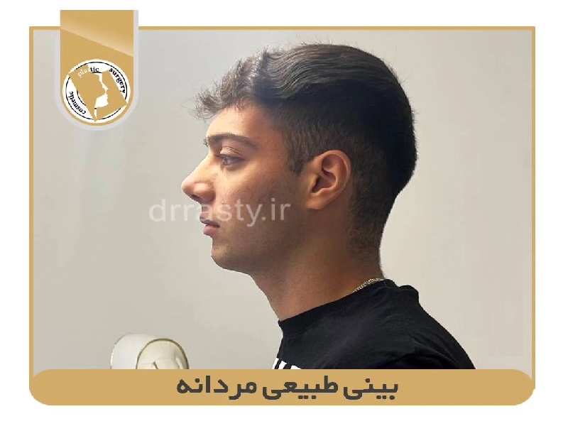 Of nose surgery | Rhinoplasty Isfahan | Male natural nose surgery