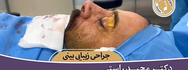 Example of male nose surgery (۷)
