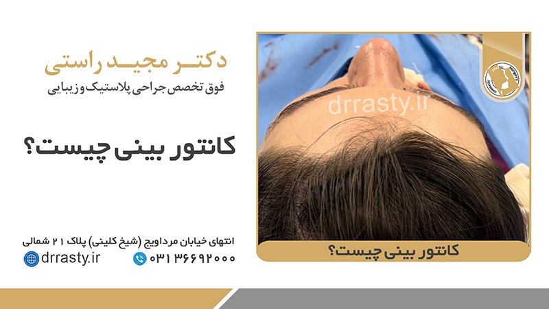 جراح بینی اصفهان |  Rhinoplasty Isfahan |  What is nose contour? | جراح بینی اصفهانOf nose surgery