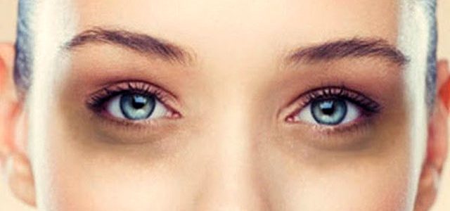 13 طرق للقضاء على العين السوداء
