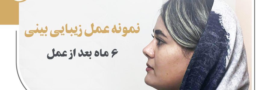 کلیپ آپارات نمونه عمل زیبایی بینی