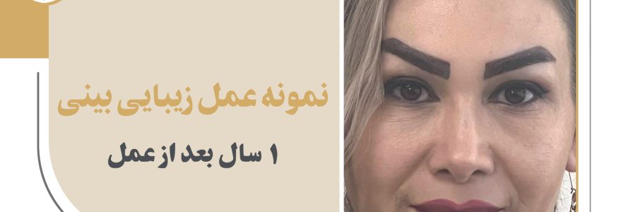 مقطع جهاز عينة جراحة الأنف