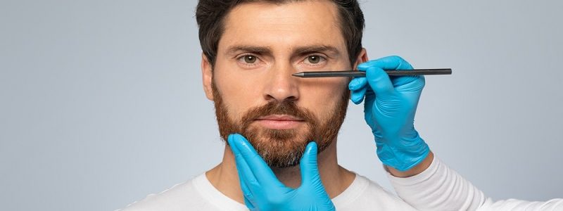 Objectives of male rhinoplasty surgery