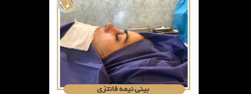 بینی نیمه فانتزی در انتهای عمل | جراح بینی اصفهان