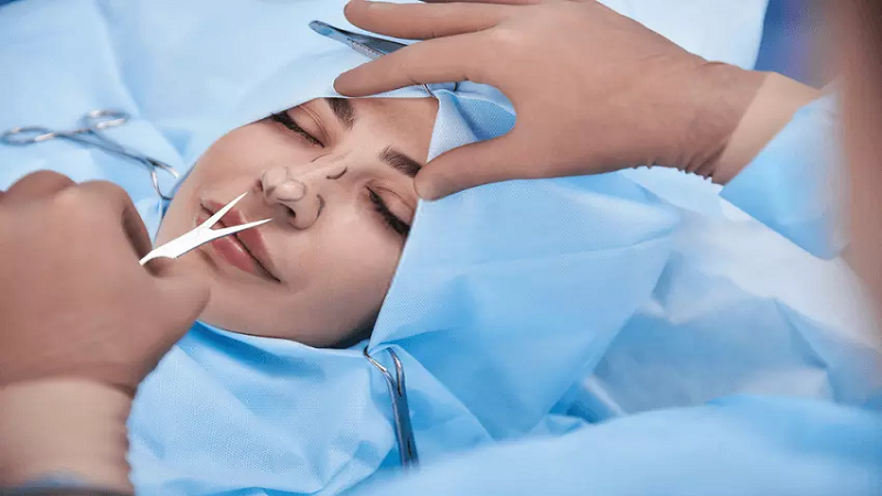 Of nose surgery | جراحی زیبایی بینی اصفهان | Rhinoplasty Isfahan ...