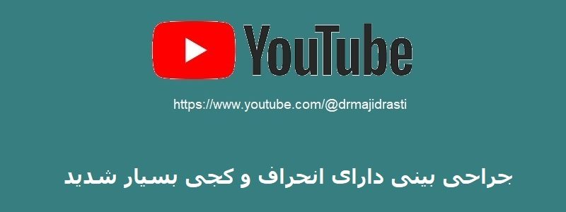 جراحی بینی دارای انحراف و کجی بسیار شدید