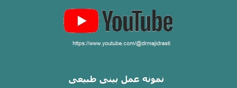 مثال على وظيفة الأنف العادية