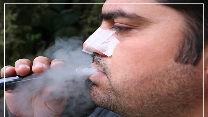 جراح بینی اصفهان | سیگار کشیدن